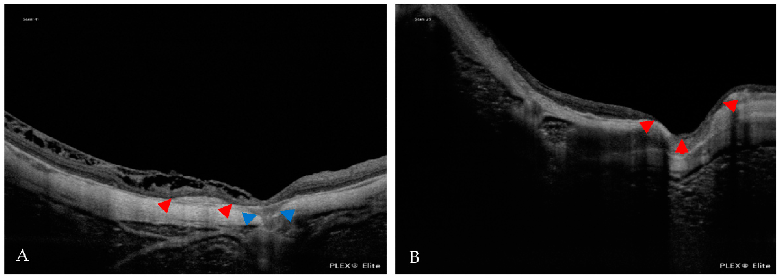 Jcm 12 01846 g011 Jcm 12 01846 g011