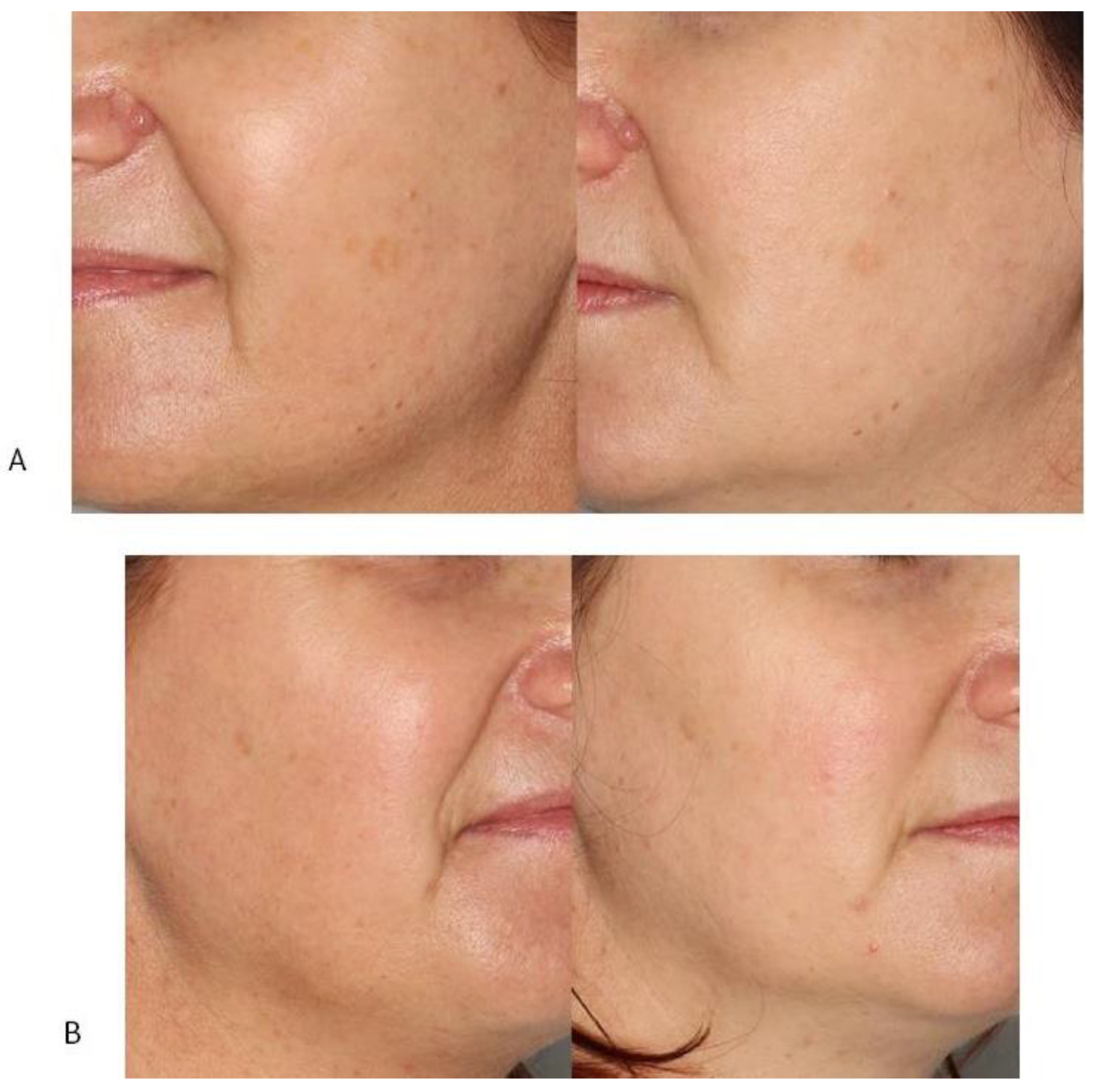 Jcm 12 01869 g007 Jcm 12 01869 g007