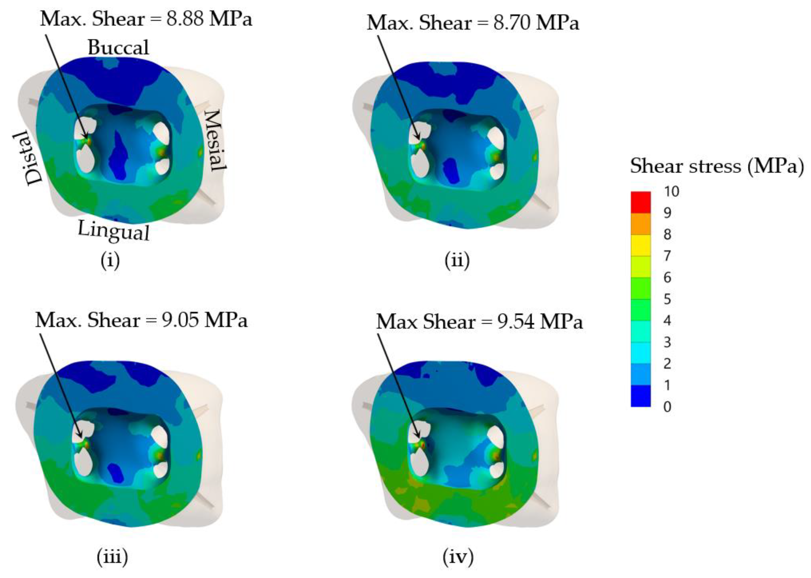 JCM Free FullText Finite Element Analysis of the Mechanical