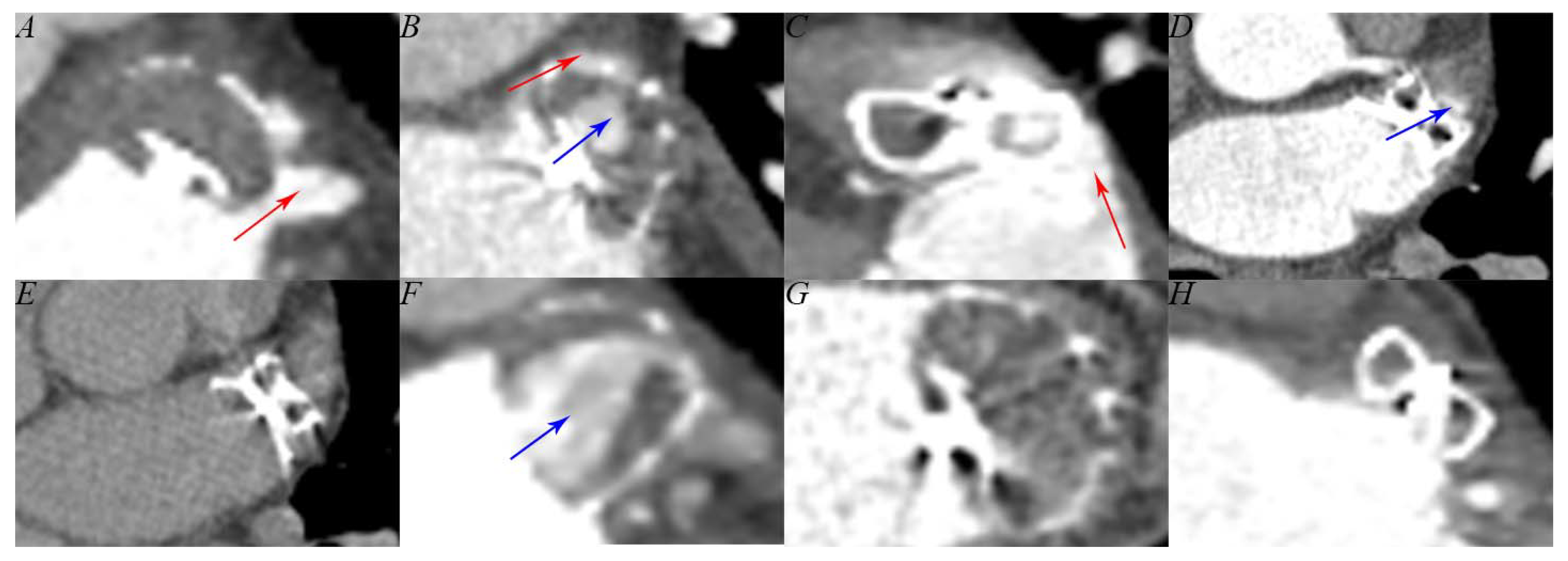 Jcm 12 01960 g002 Jcm 12 01960 g002