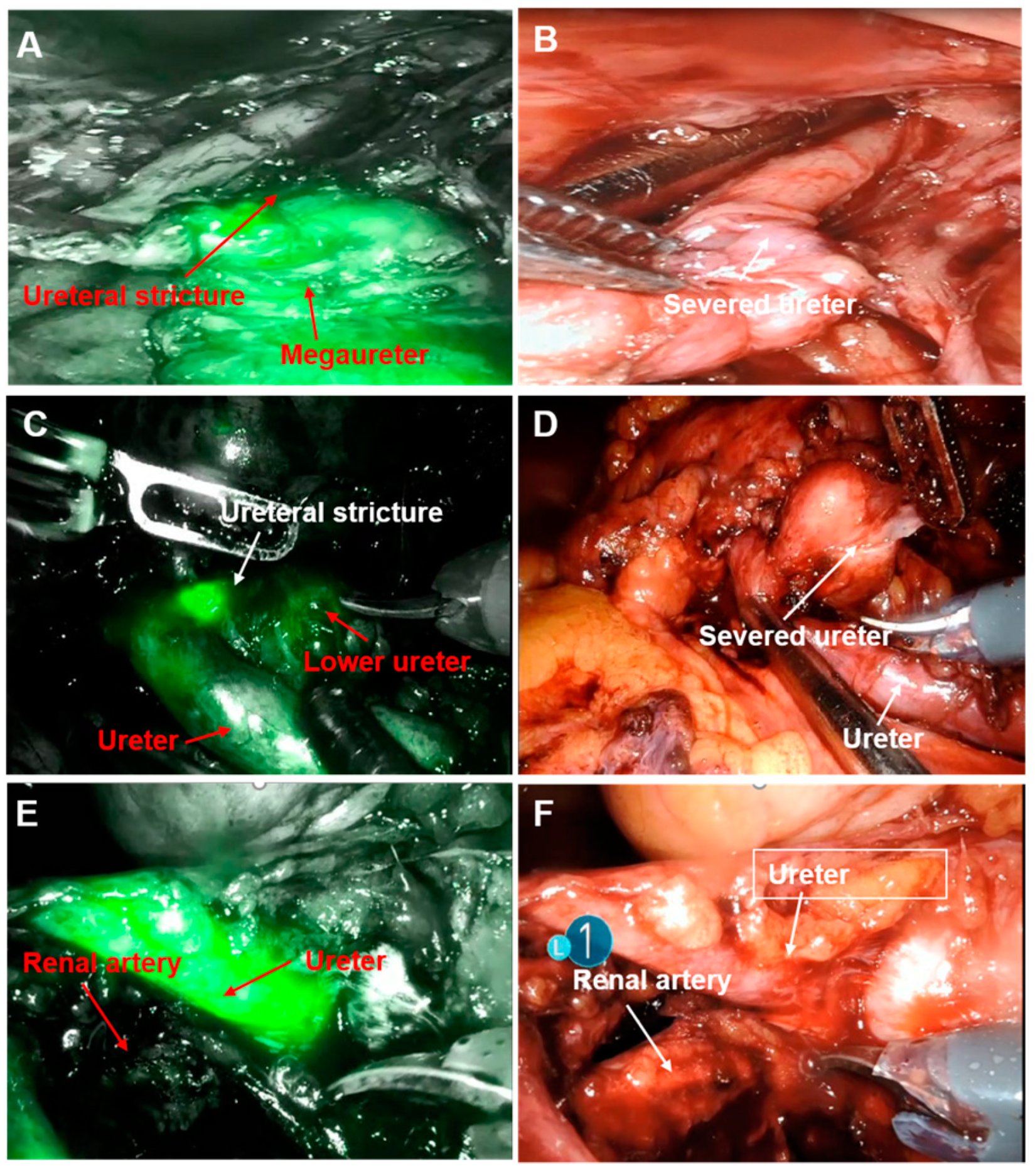 Jcm 12 01980 g002 Jcm 12 01980 g002