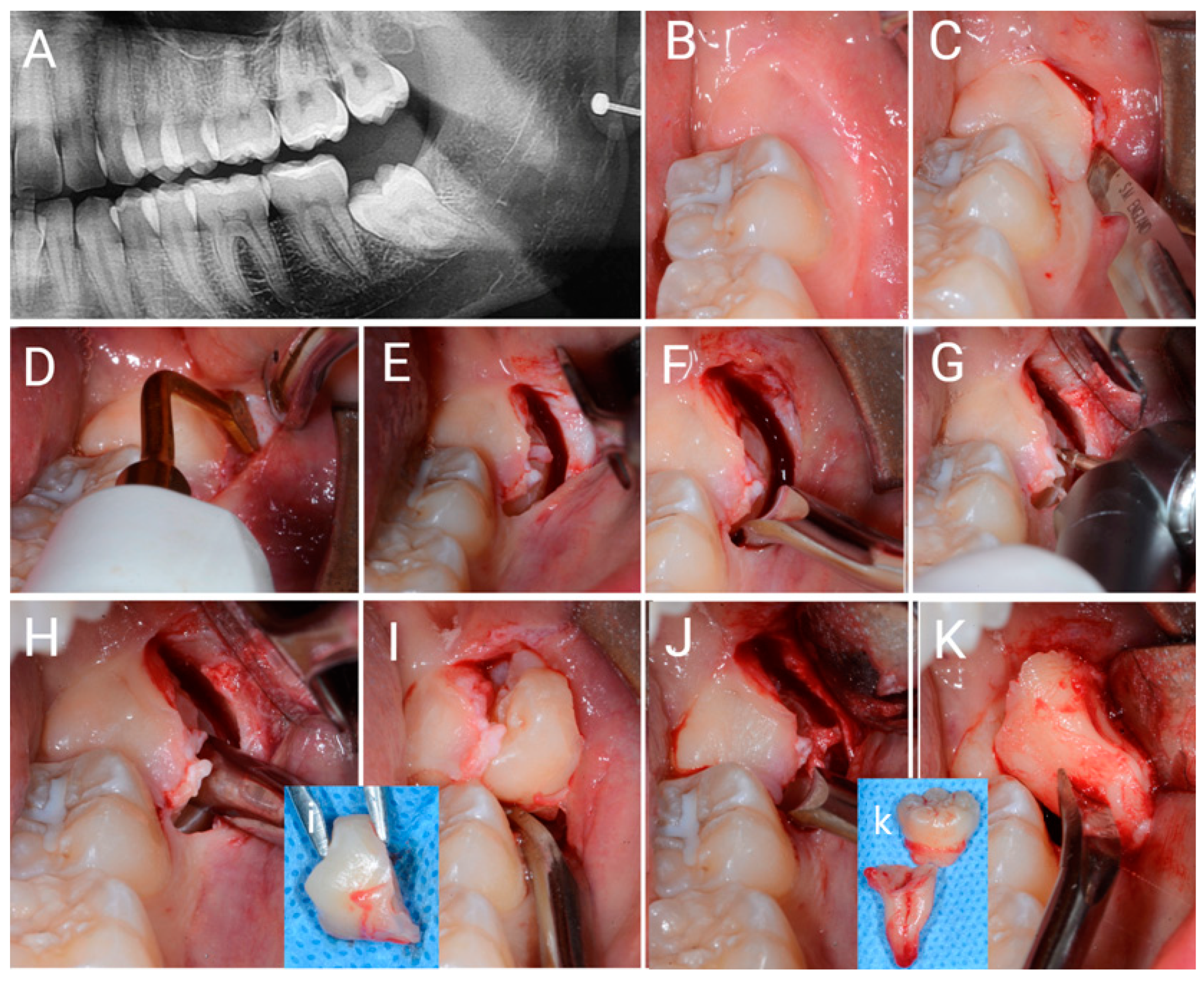 Jcm 12 01995 g004 Jcm 12 01995 g004