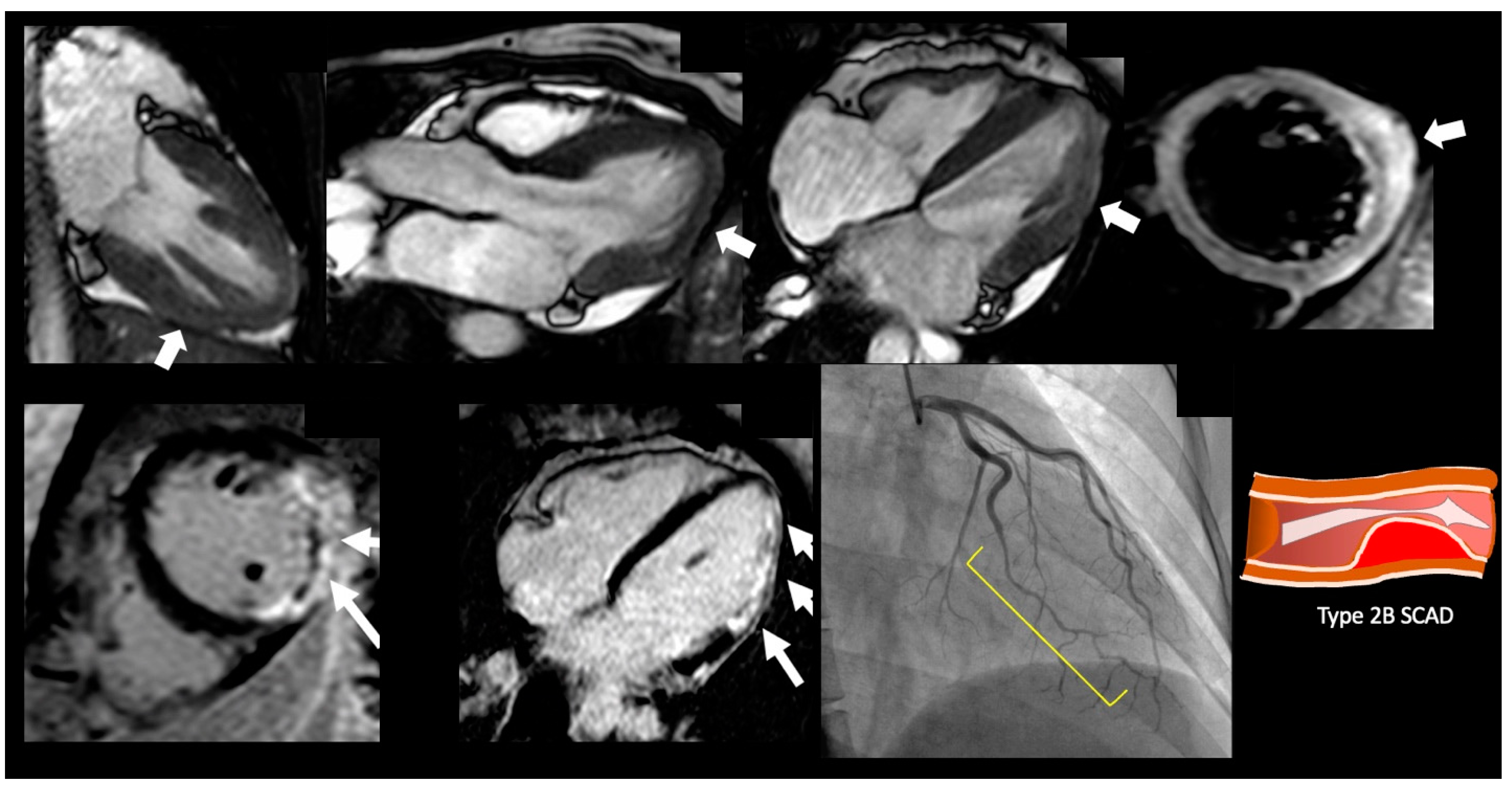 Jcm 12 02017 g002 Jcm 12 02017 g002