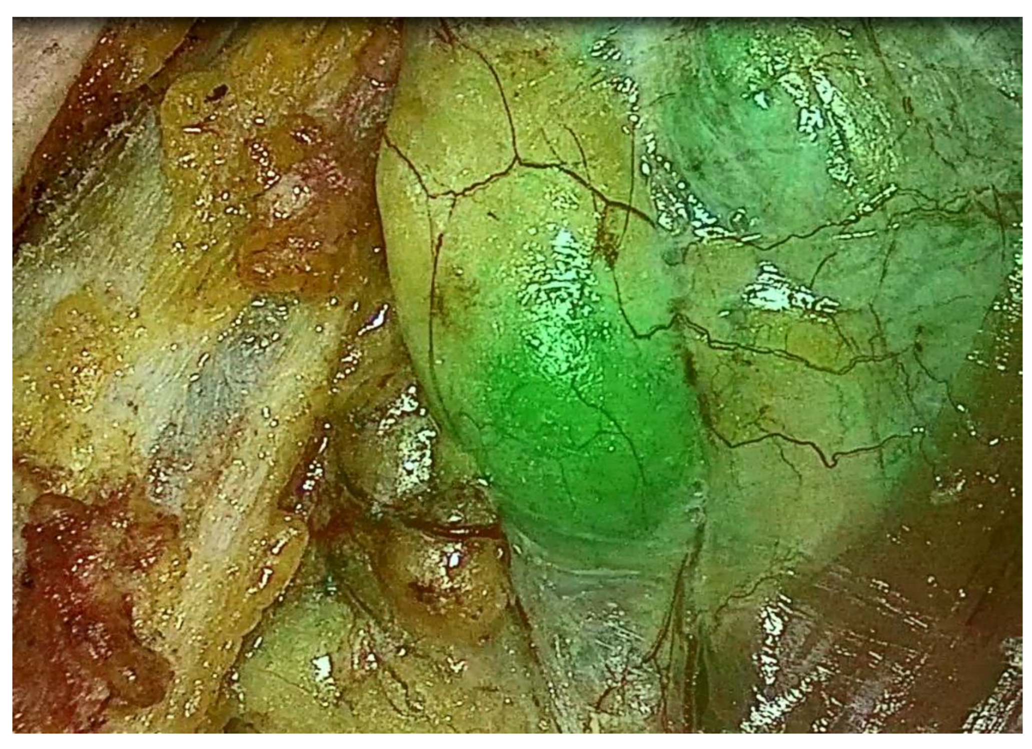 Jcm 12 02057 g002 Jcm 12 02057 g002