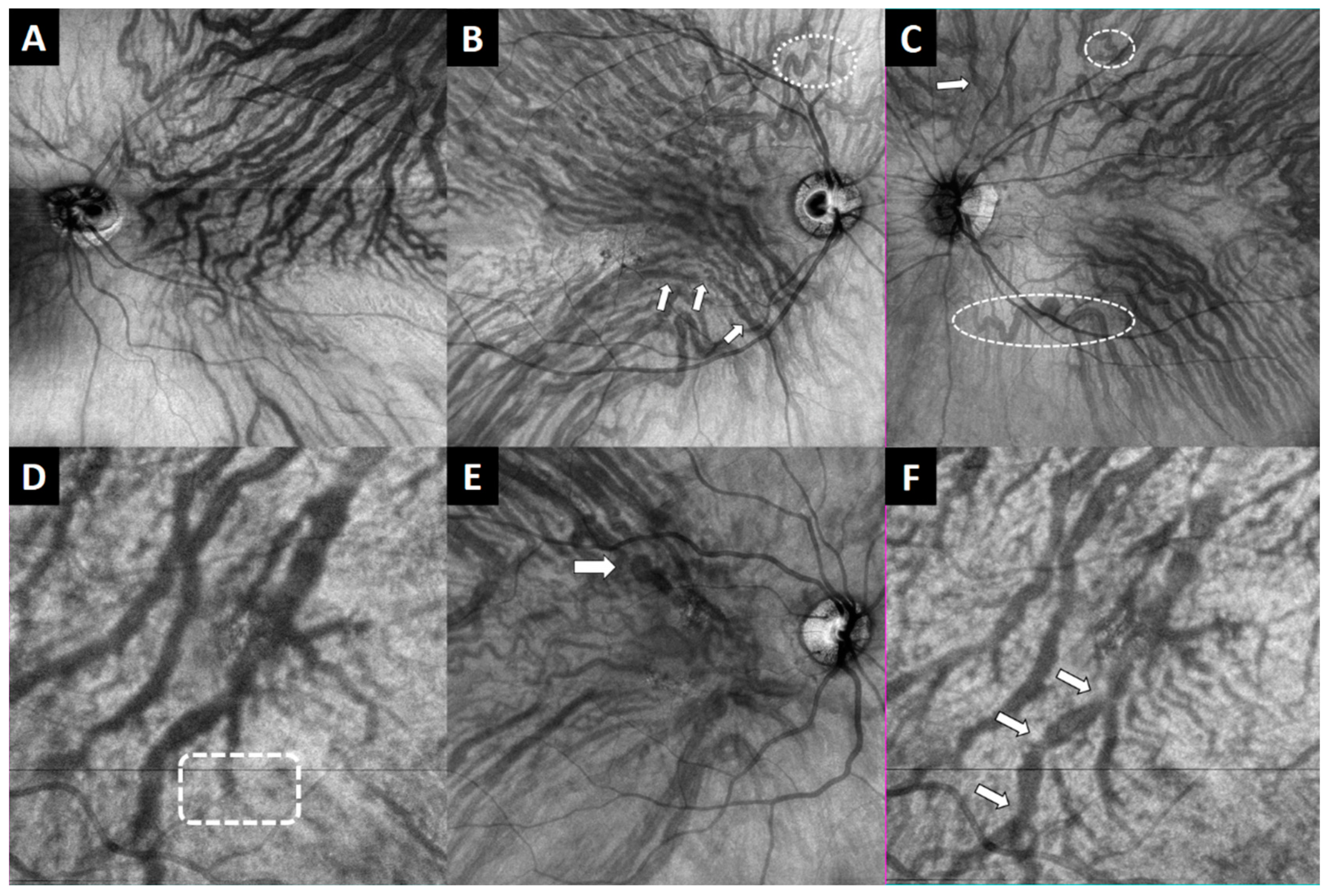 Jcm 12 02088 g003 Jcm 12 02088 g003