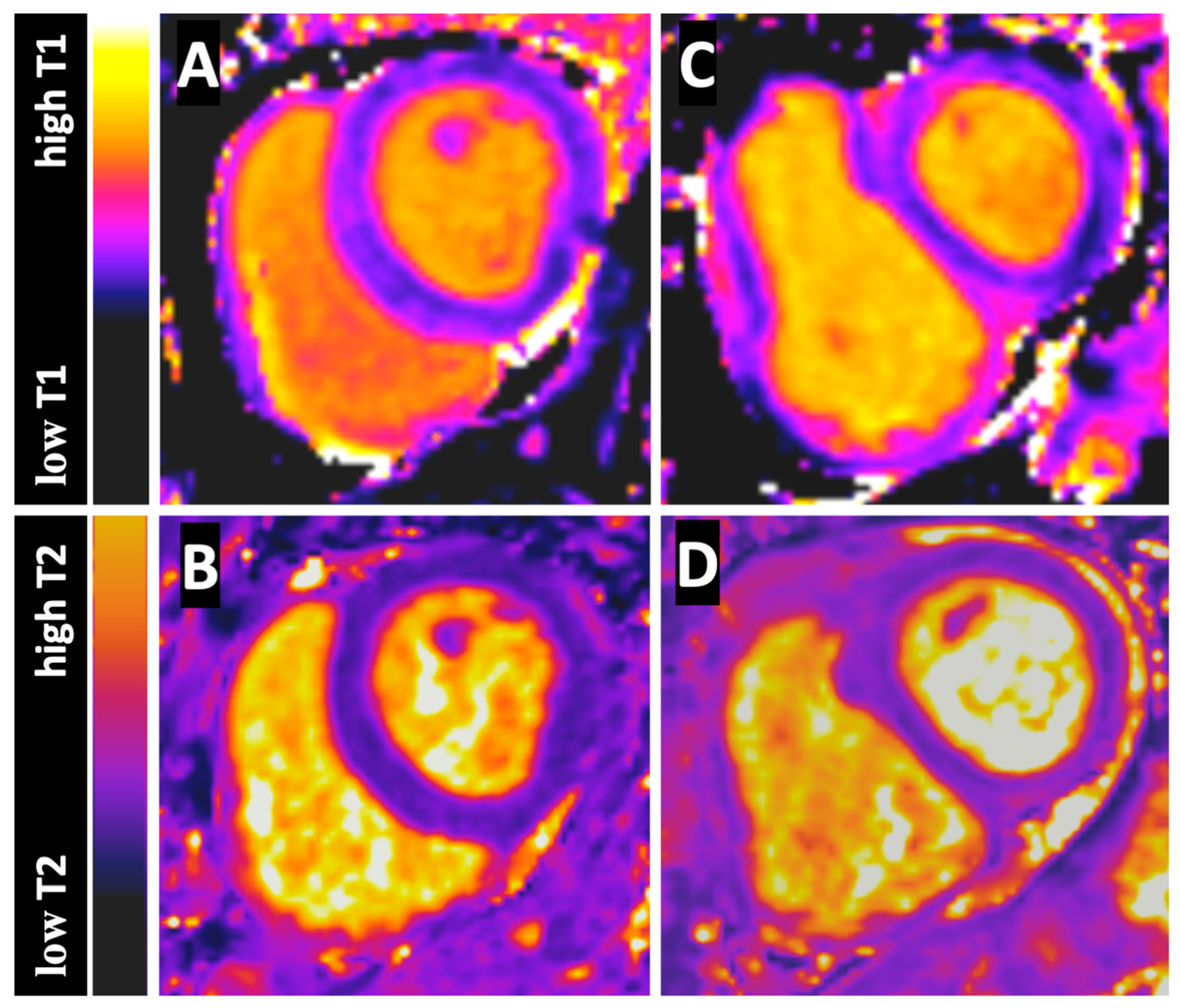 T2 Relaxation Times at Cardiac MRI in Healthy Adults: A Systematic