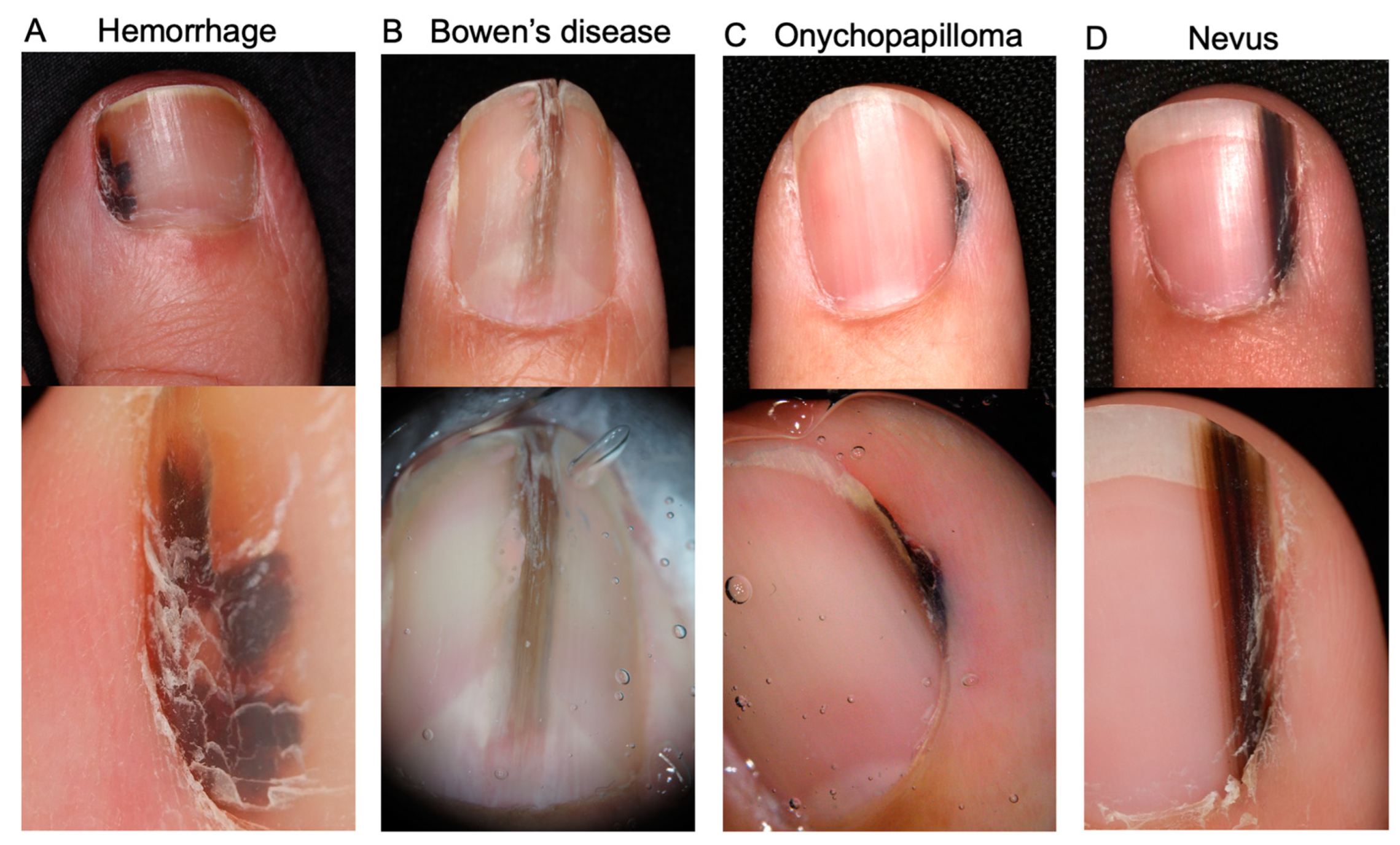 Nail Changes Reflect Your Dermatologic Health