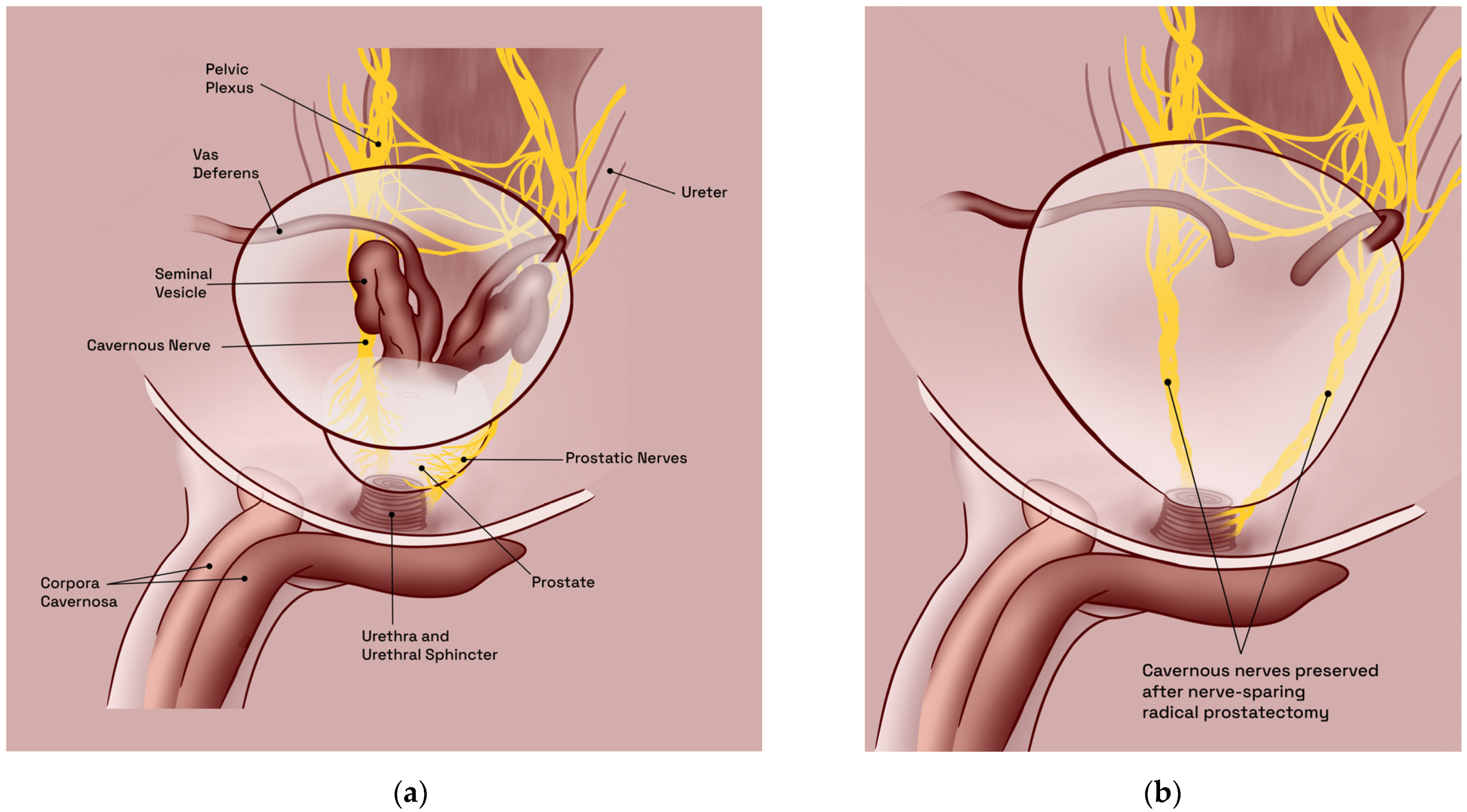 Figure 2. Comparative illustrations of male pelvic anatomy in humans, obliq...