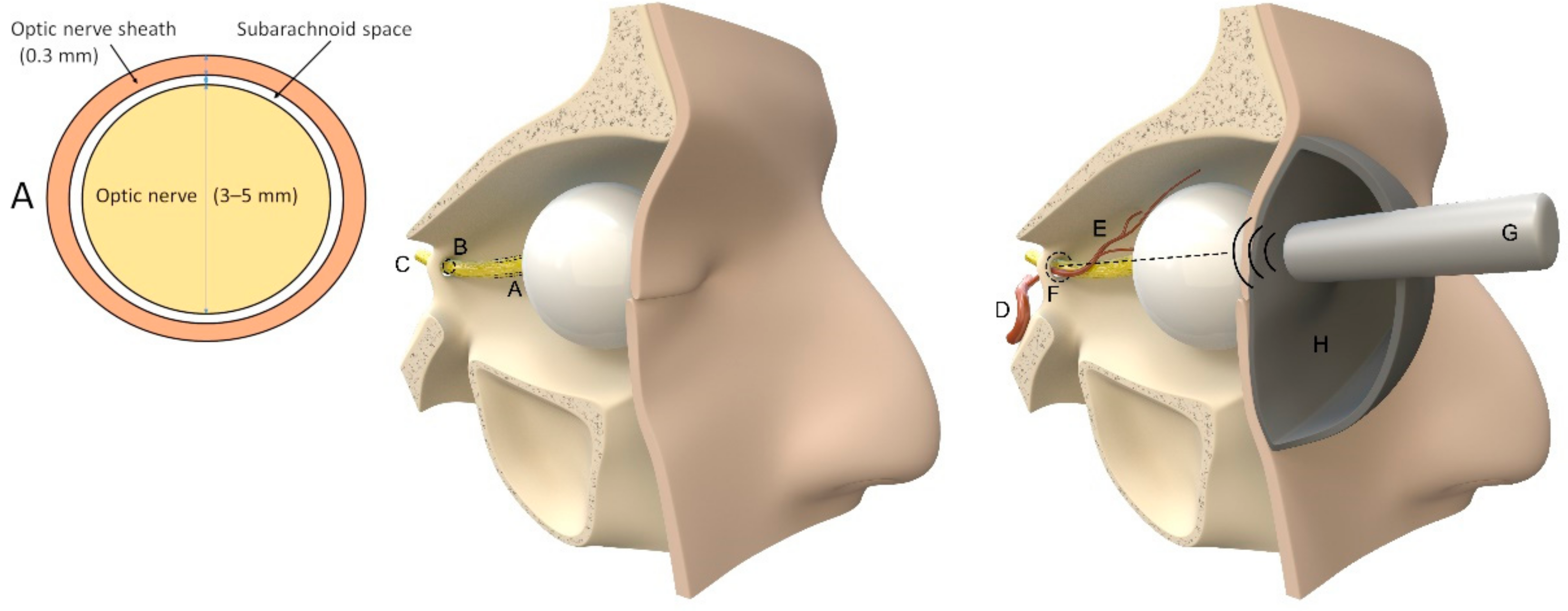 Jcm 12 02209 g004 Jcm 12 02209 g004