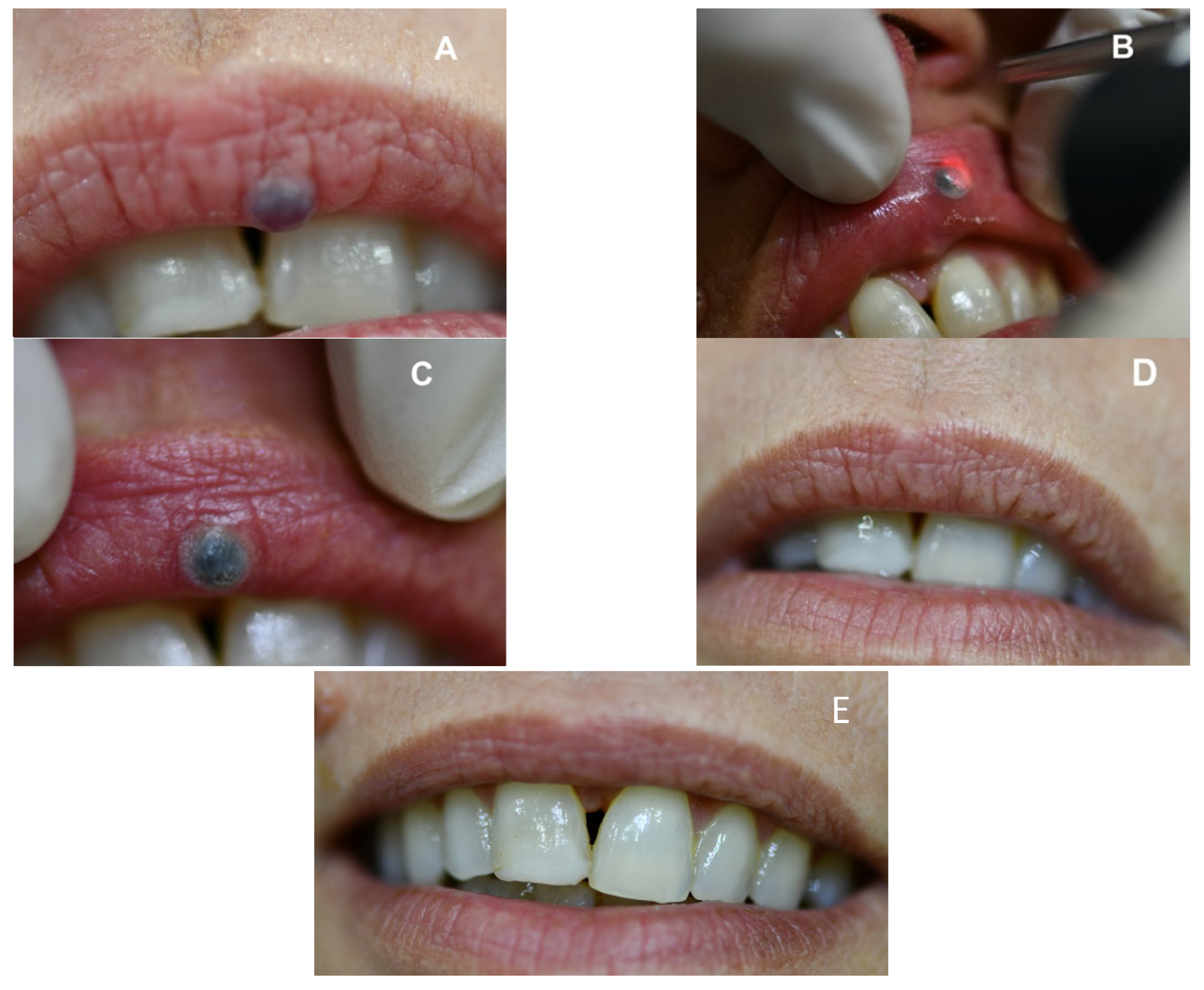 Jcm 12 02292 g002 Jcm 12 02292 g002