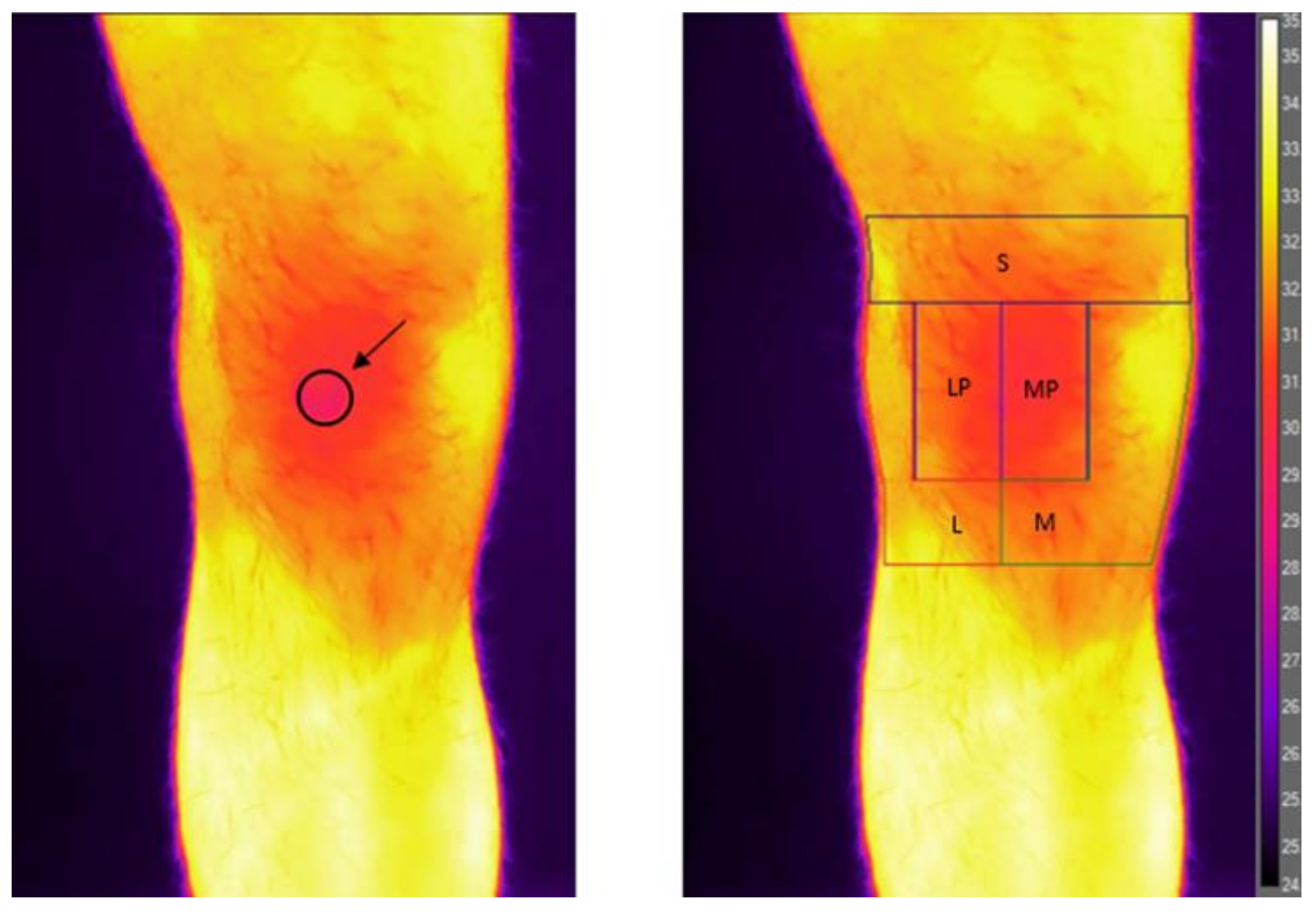 Jcm 12 02319 g001 Jcm 12 02319 g001