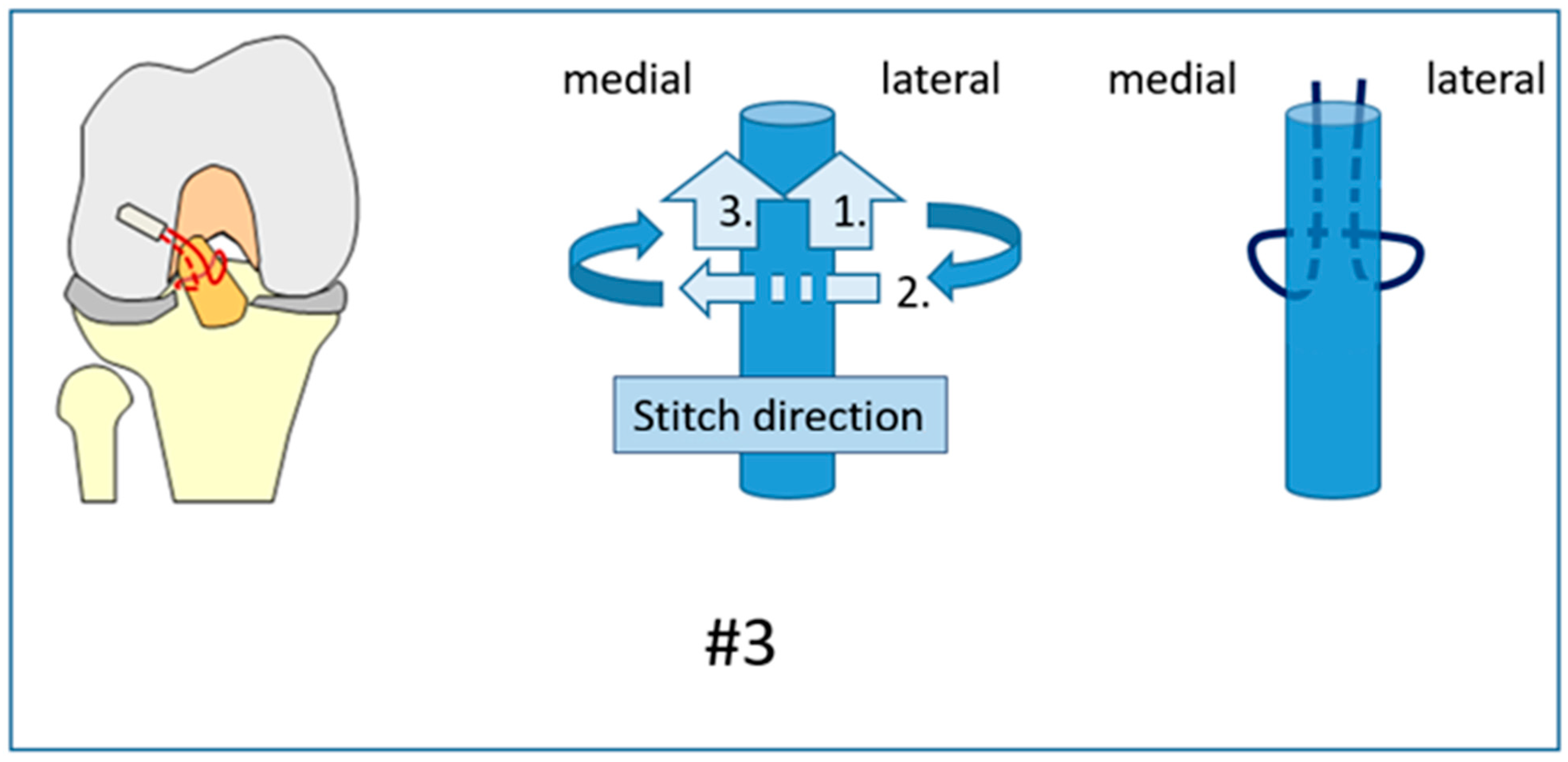 Jcm 12 02340 g003 Jcm 12 02340 g003