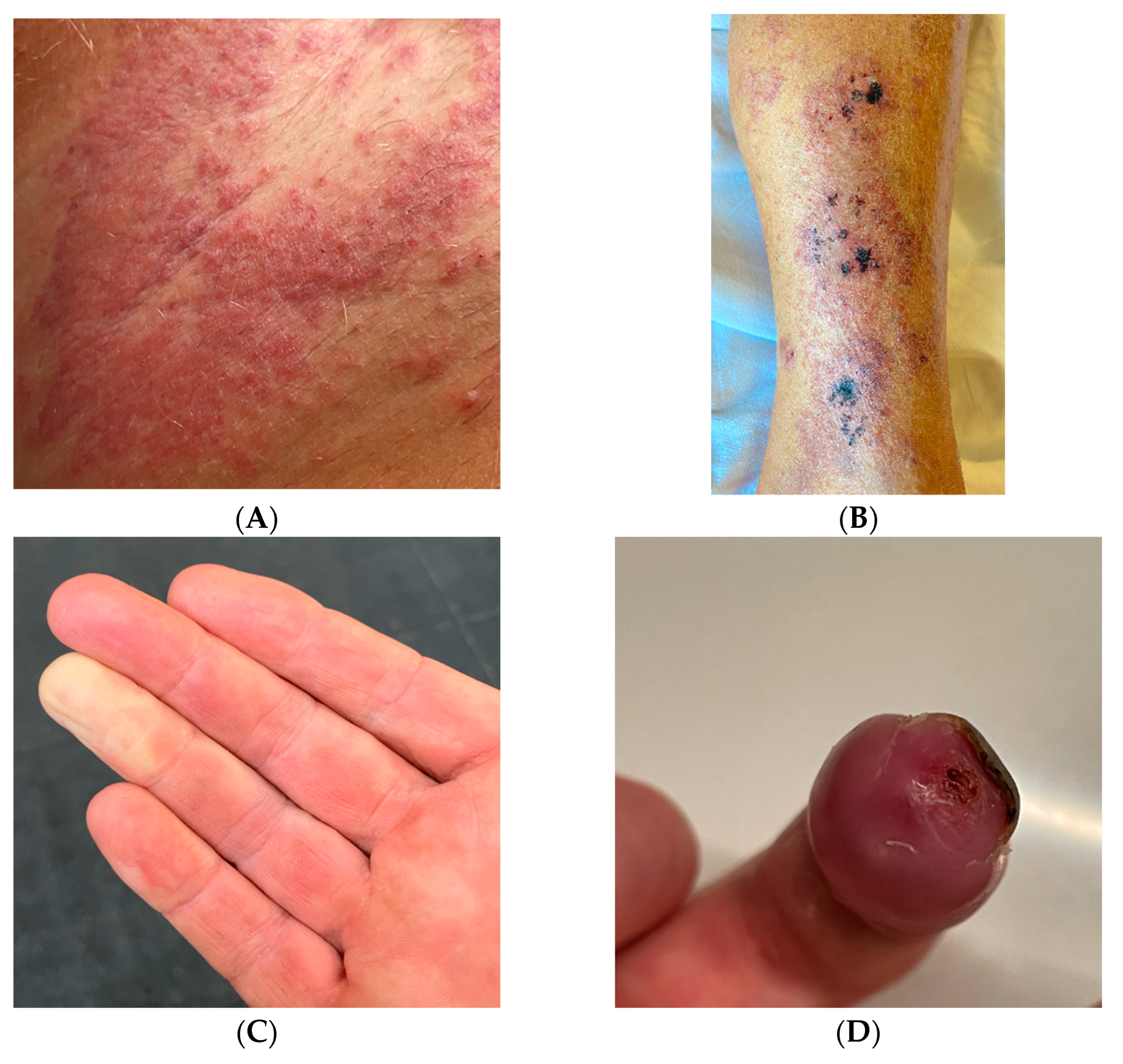 Jcm 12 02376 g001 Jcm 12 02376 g001