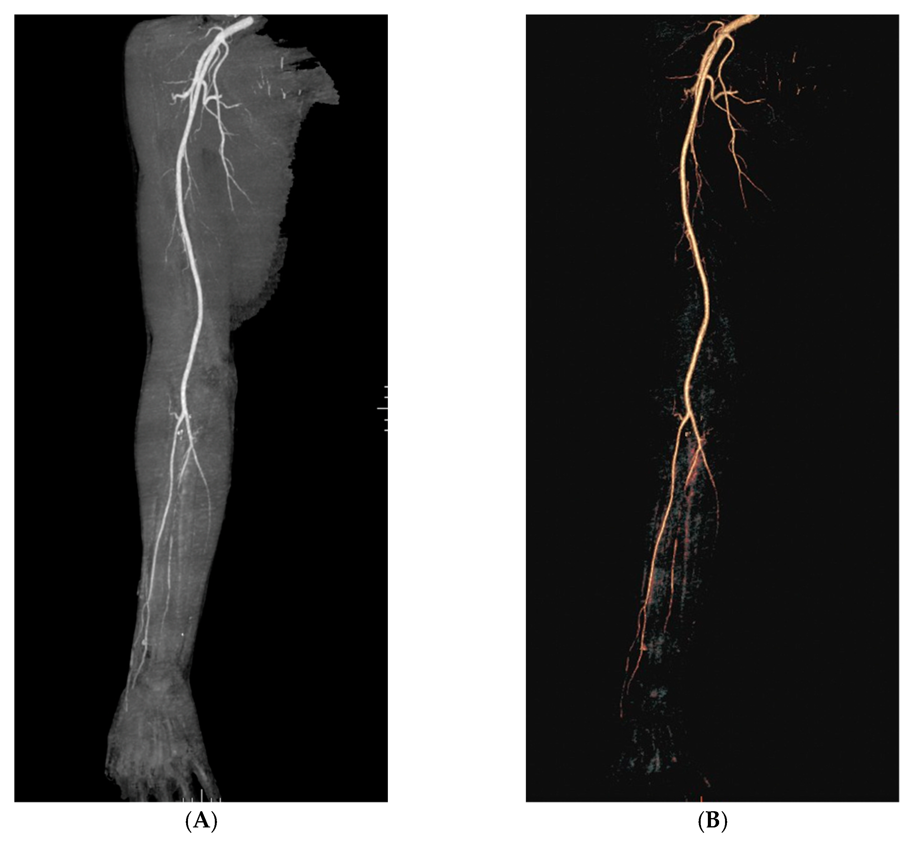Jcm 12 02376 g002 Jcm 12 02376 g002