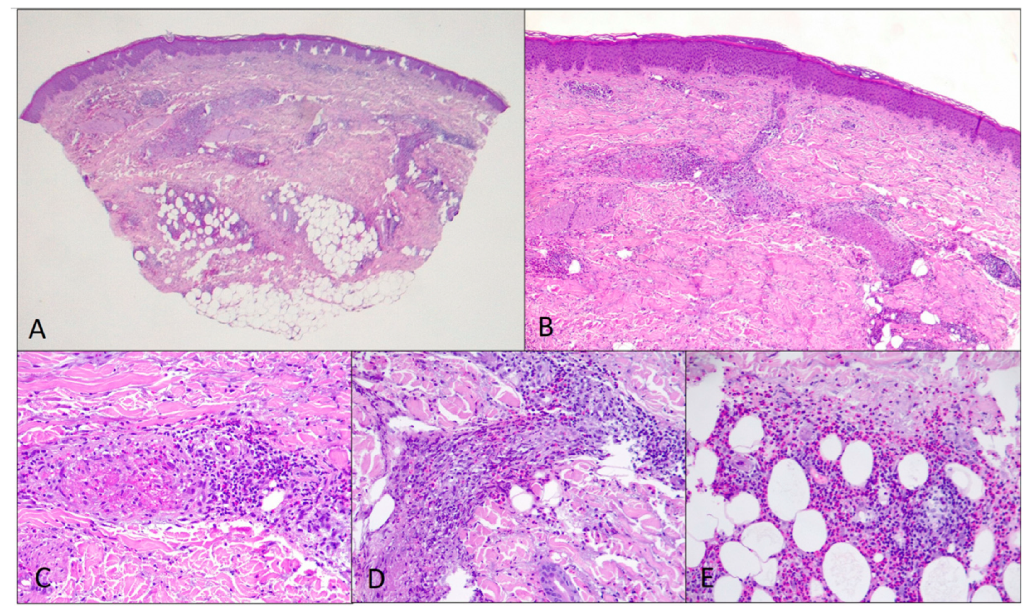 Jcm 12 02376 g004 Jcm 12 02376 g004