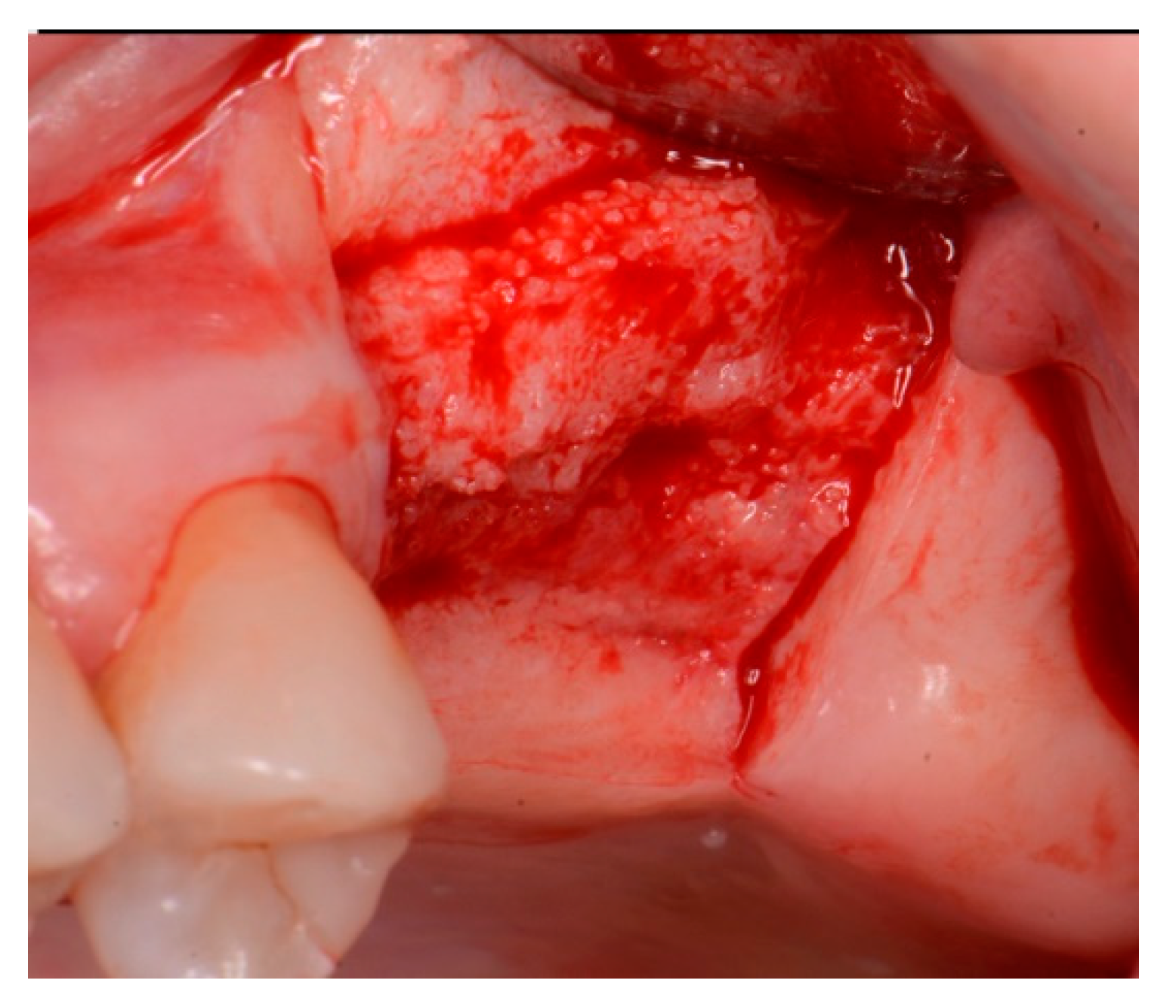 Jcm 12 02485 g003 Jcm 12 02485 g003