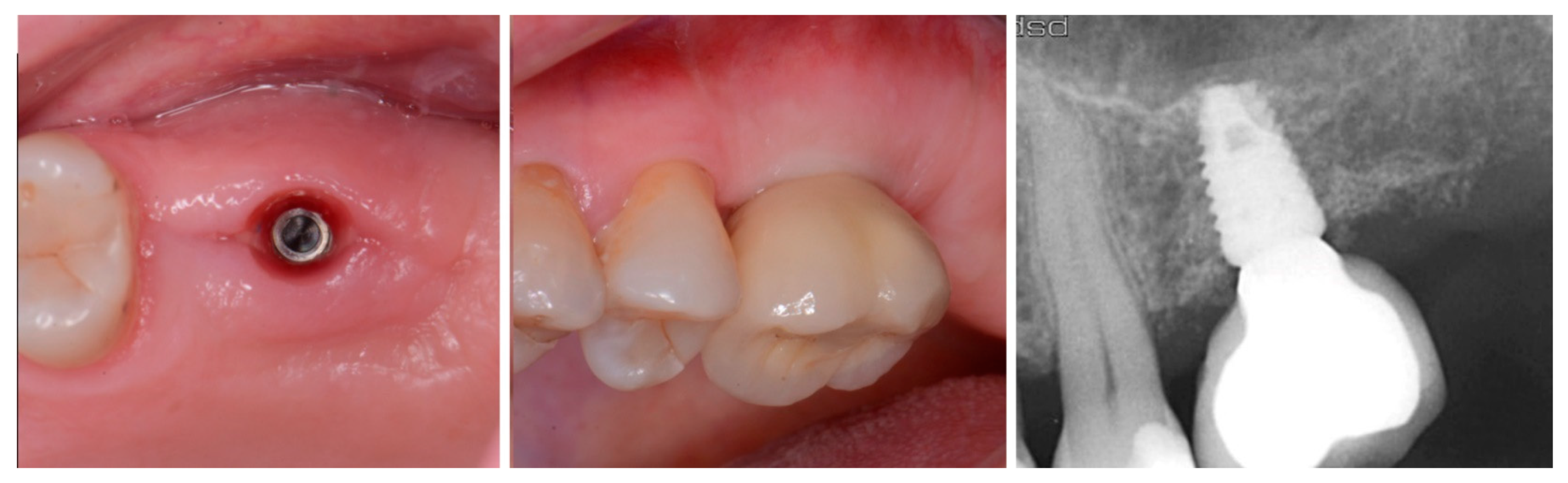 Jcm 12 02485 g006 Jcm 12 02485 g006