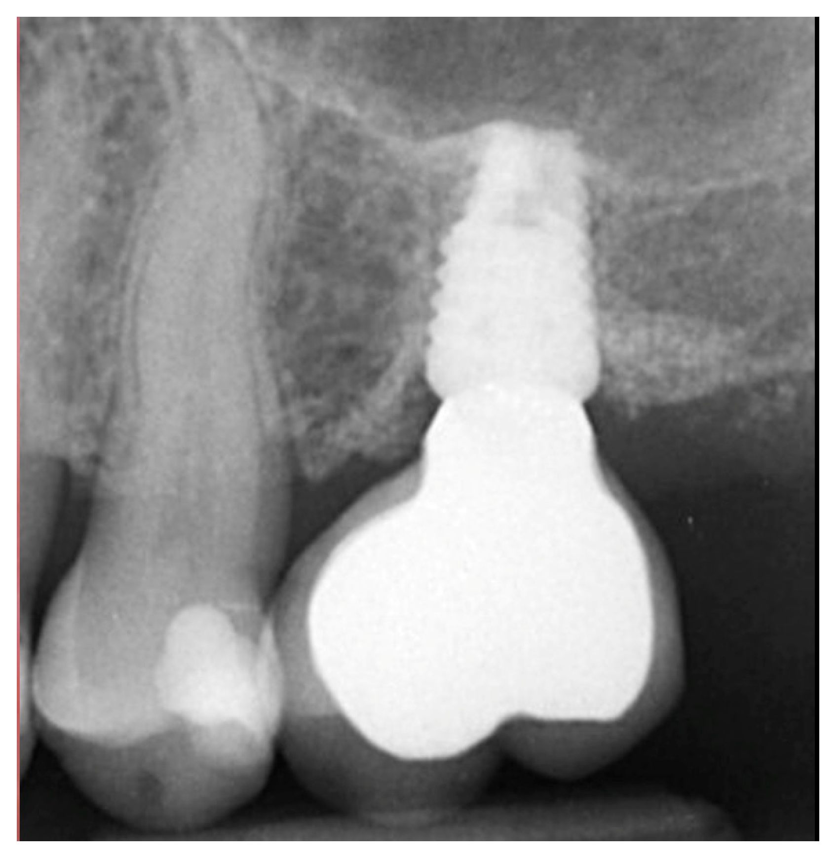 Jcm 12 02485 g007 Jcm 12 02485 g007