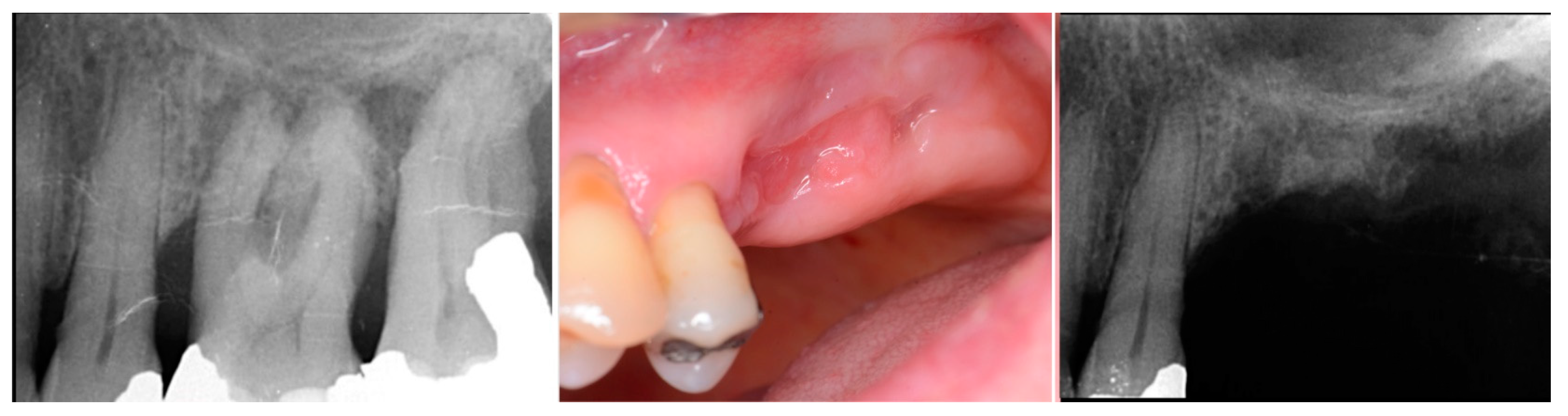 Jcm 12 02485 g008 Jcm 12 02485 g008