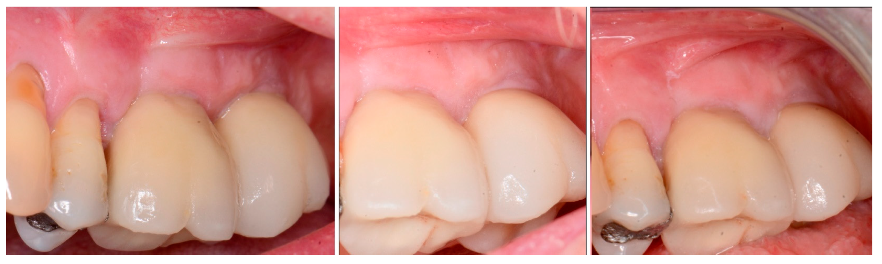 Jcm 12 02485 g014 Jcm 12 02485 g014