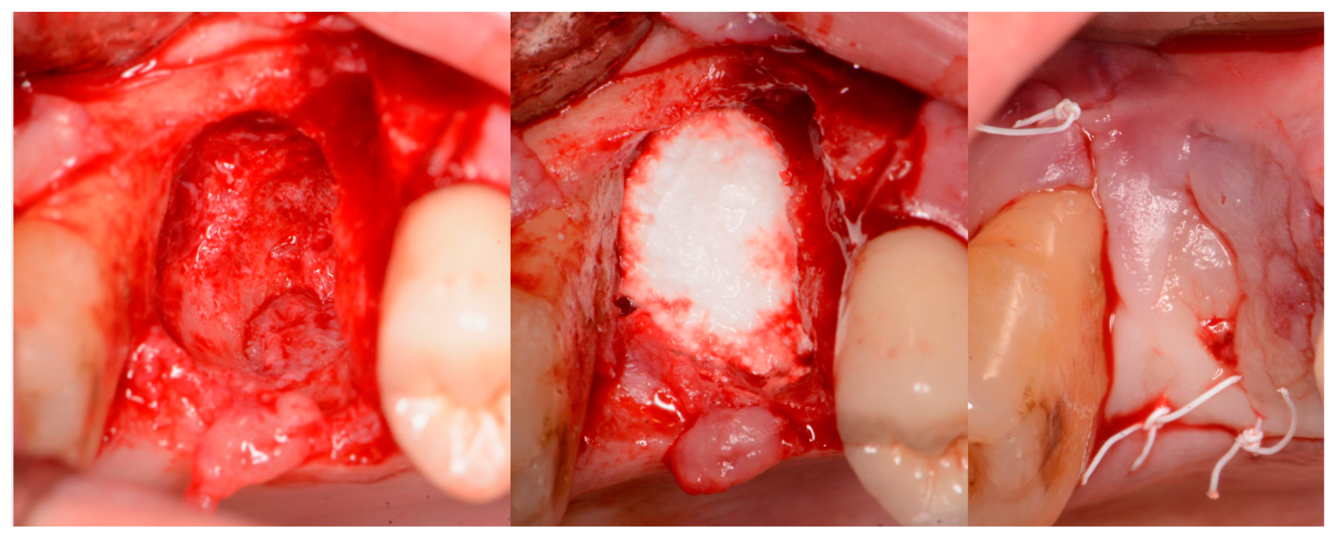 Jcm 12 02485 g018 Jcm 12 02485 g018