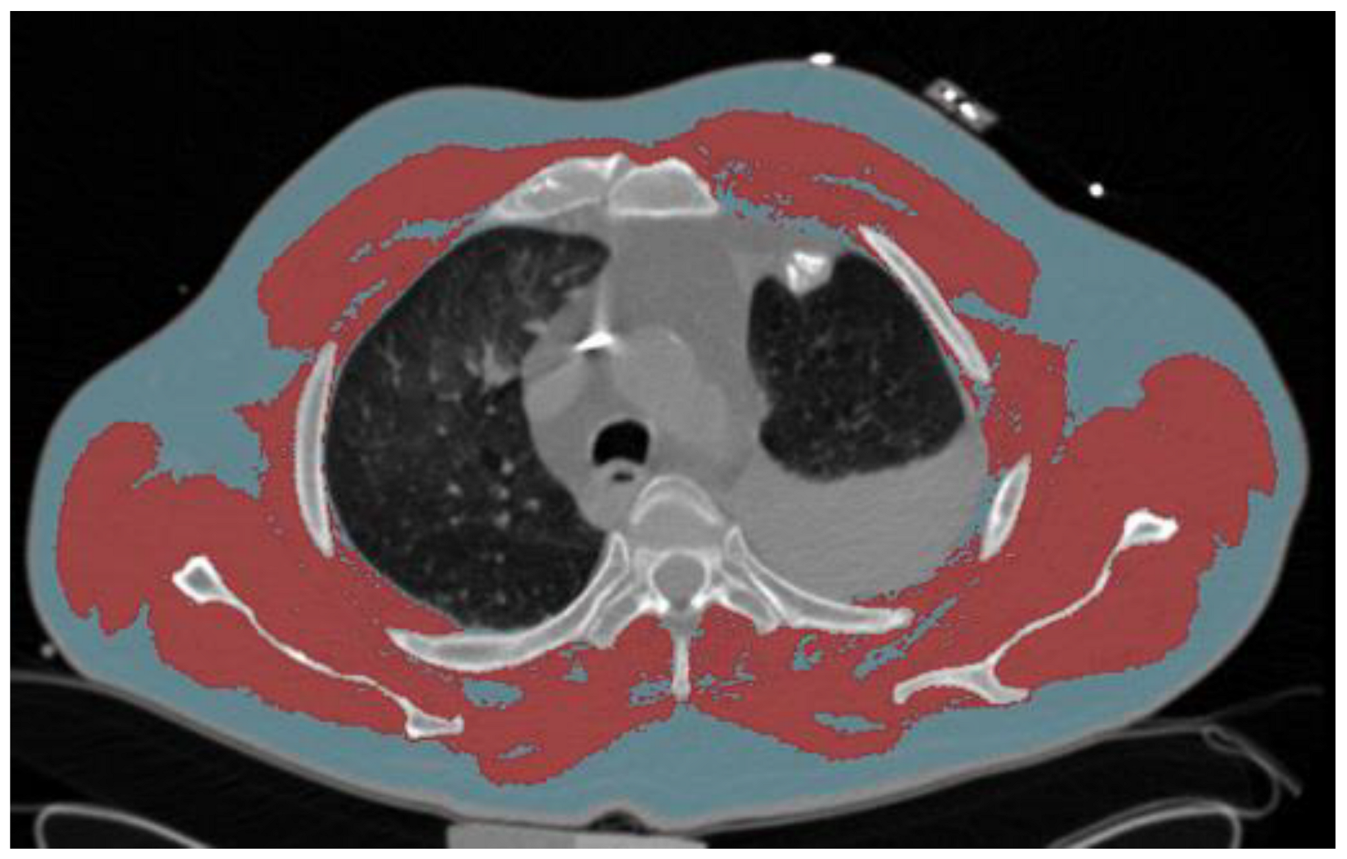 Jcm 12 02520 g002 Jcm 12 02520 g002