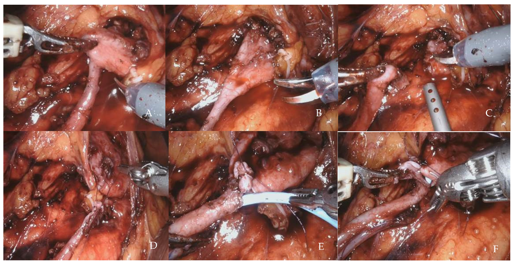 Jcm 12 02538 g002 Jcm 12 02538 g002