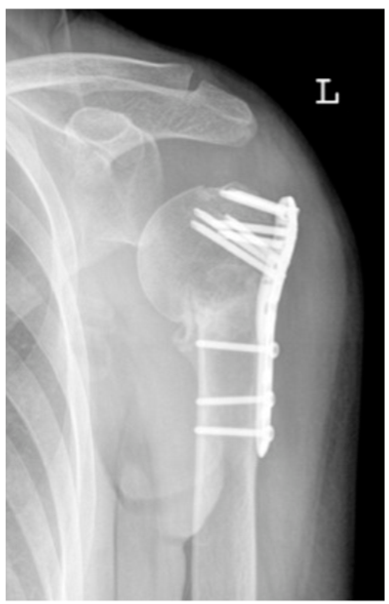 Jcm 12 02556 g005 Jcm 12 02556 g005