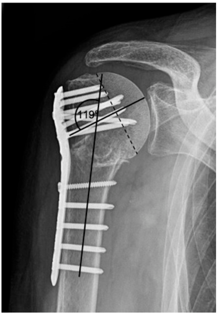 Jcm 12 02556 g006 Jcm 12 02556 g006