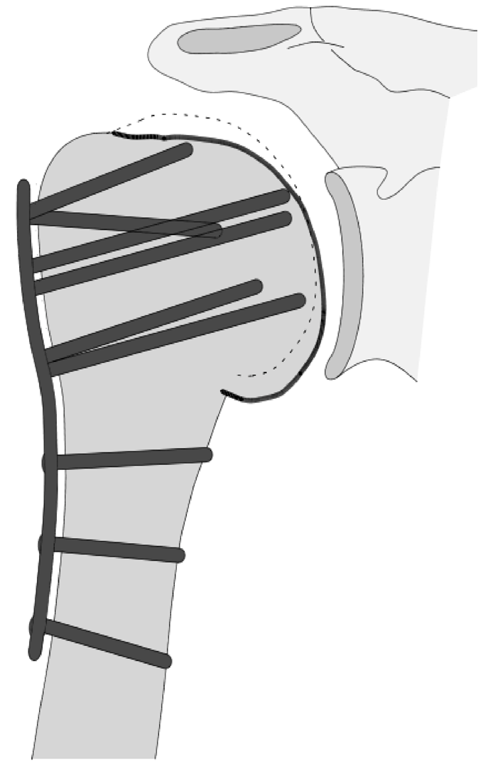 Jcm 12 02556 g007 Jcm 12 02556 g007