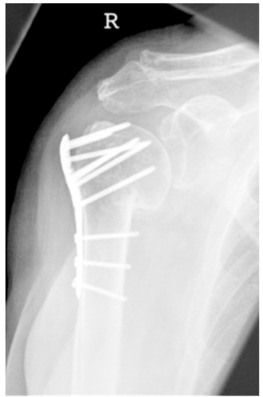 Jcm 12 02556 g008 Jcm 12 02556 g008