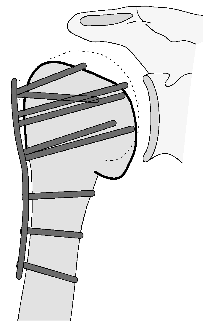 Jcm 12 02556 g010 Jcm 12 02556 g010