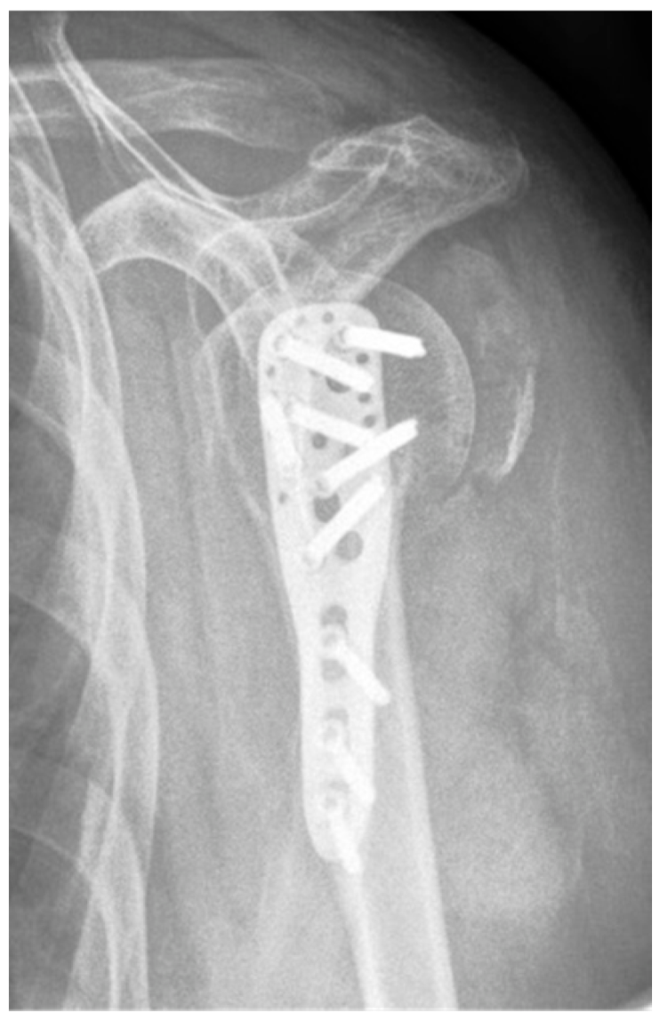 Jcm 12 02556 g011 Jcm 12 02556 g011