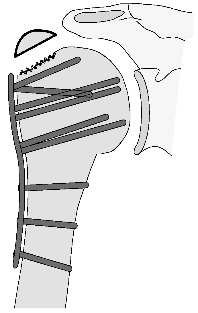 Jcm 12 02556 g012 Jcm 12 02556 g012