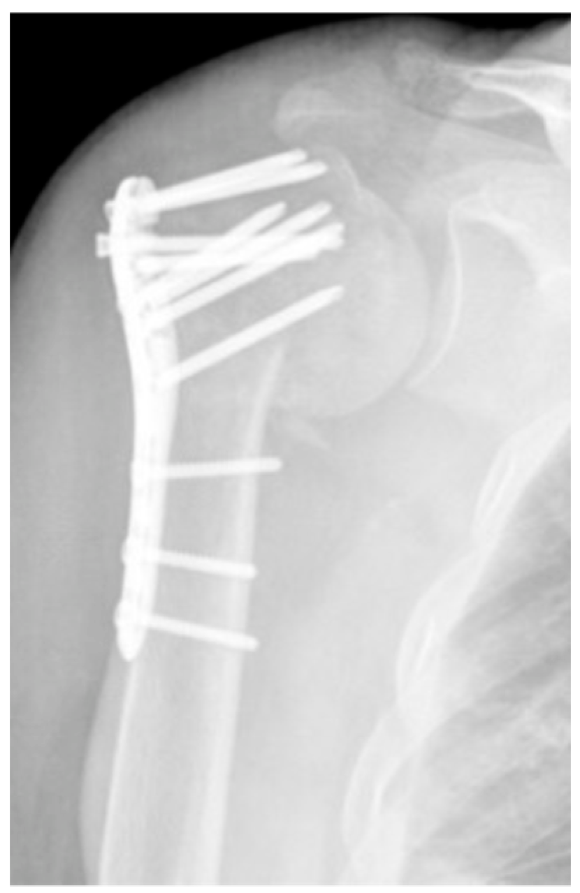 Jcm 12 02556 g013 Jcm 12 02556 g013