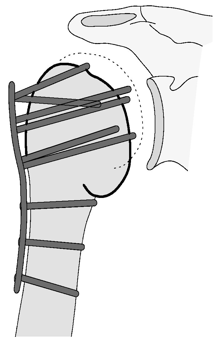 Jcm 12 02556 g015 Jcm 12 02556 g015