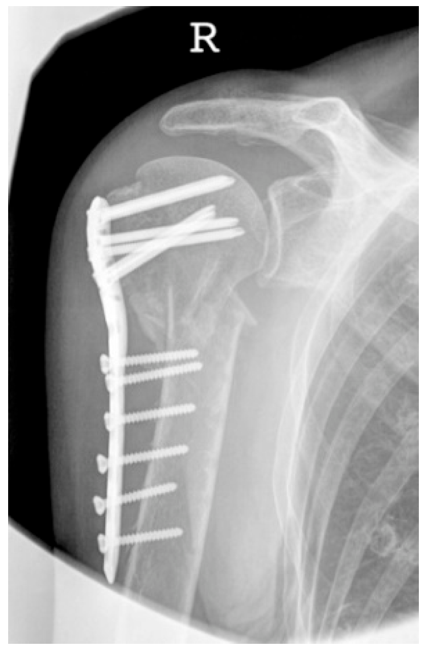 Jcm 12 02556 g016 Jcm 12 02556 g016