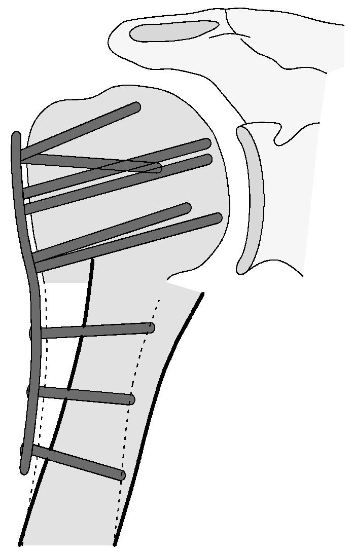 Jcm 12 02556 g017 Jcm 12 02556 g017