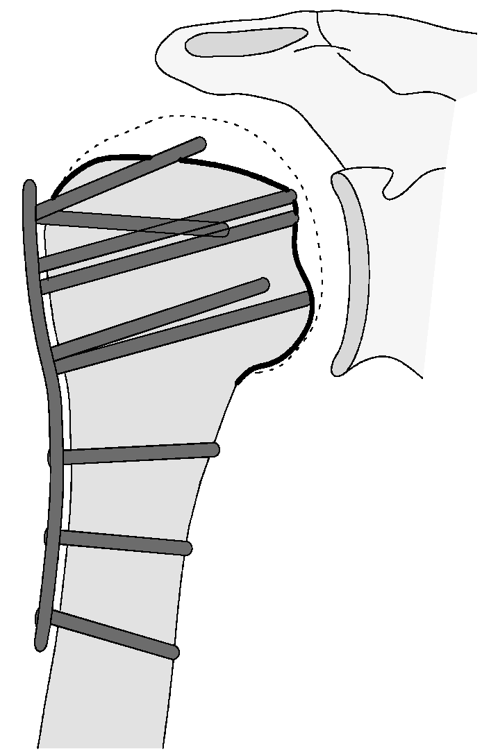 Jcm 12 02556 g019 Jcm 12 02556 g019