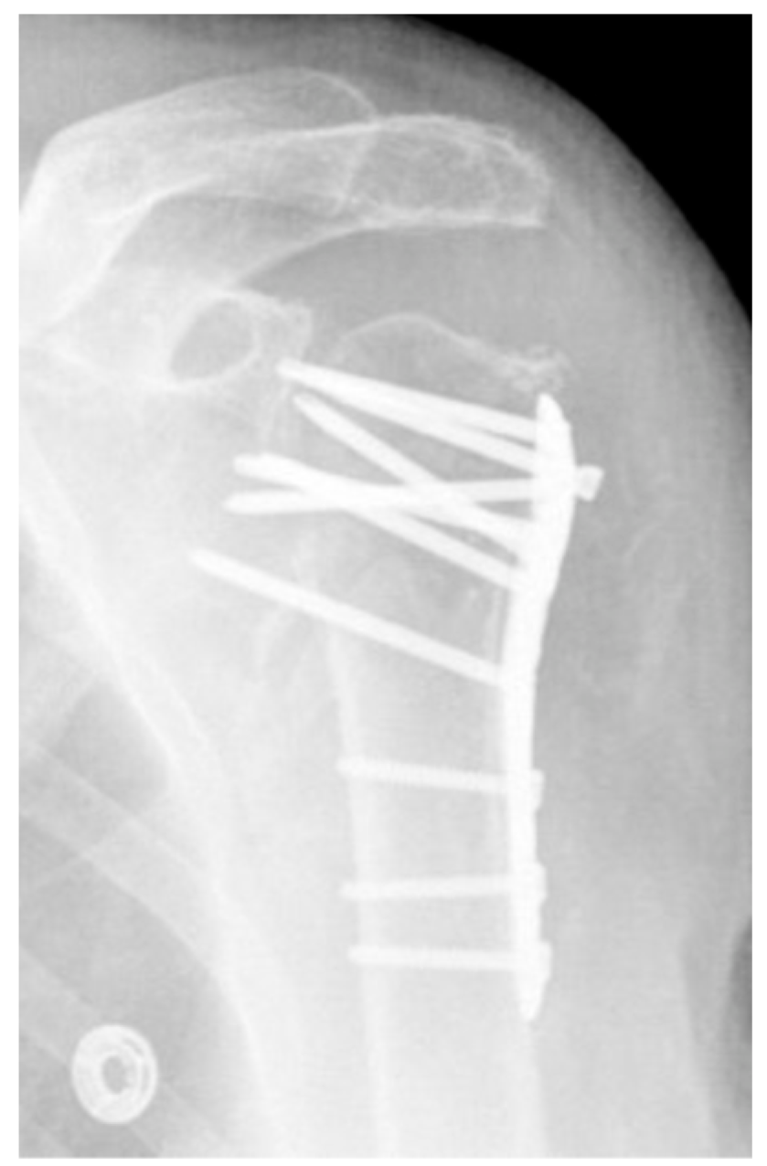 Jcm 12 02556 g020 Jcm 12 02556 g020