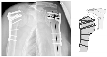 Jcm 12 02556 i004 Jcm 12 02556 i004