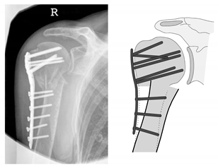 Jcm 12 02556 i005 Jcm 12 02556 i005