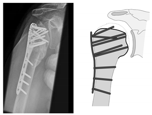 Jcm 12 02556 i006 Jcm 12 02556 i006