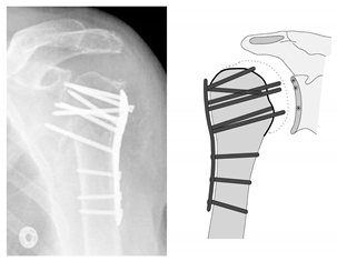 Jcm 12 02556 i007 Jcm 12 02556 i007