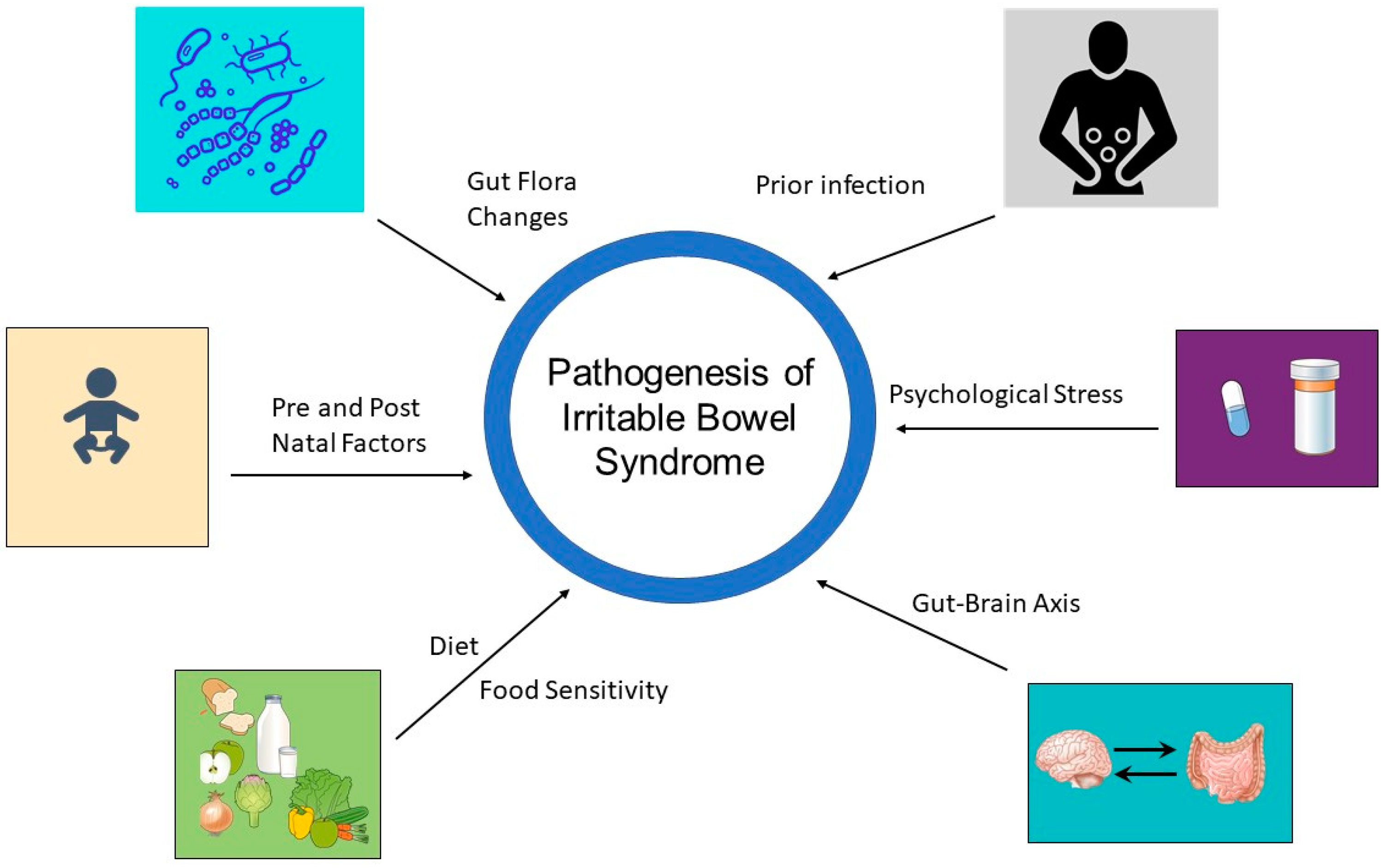 ibs stool shape