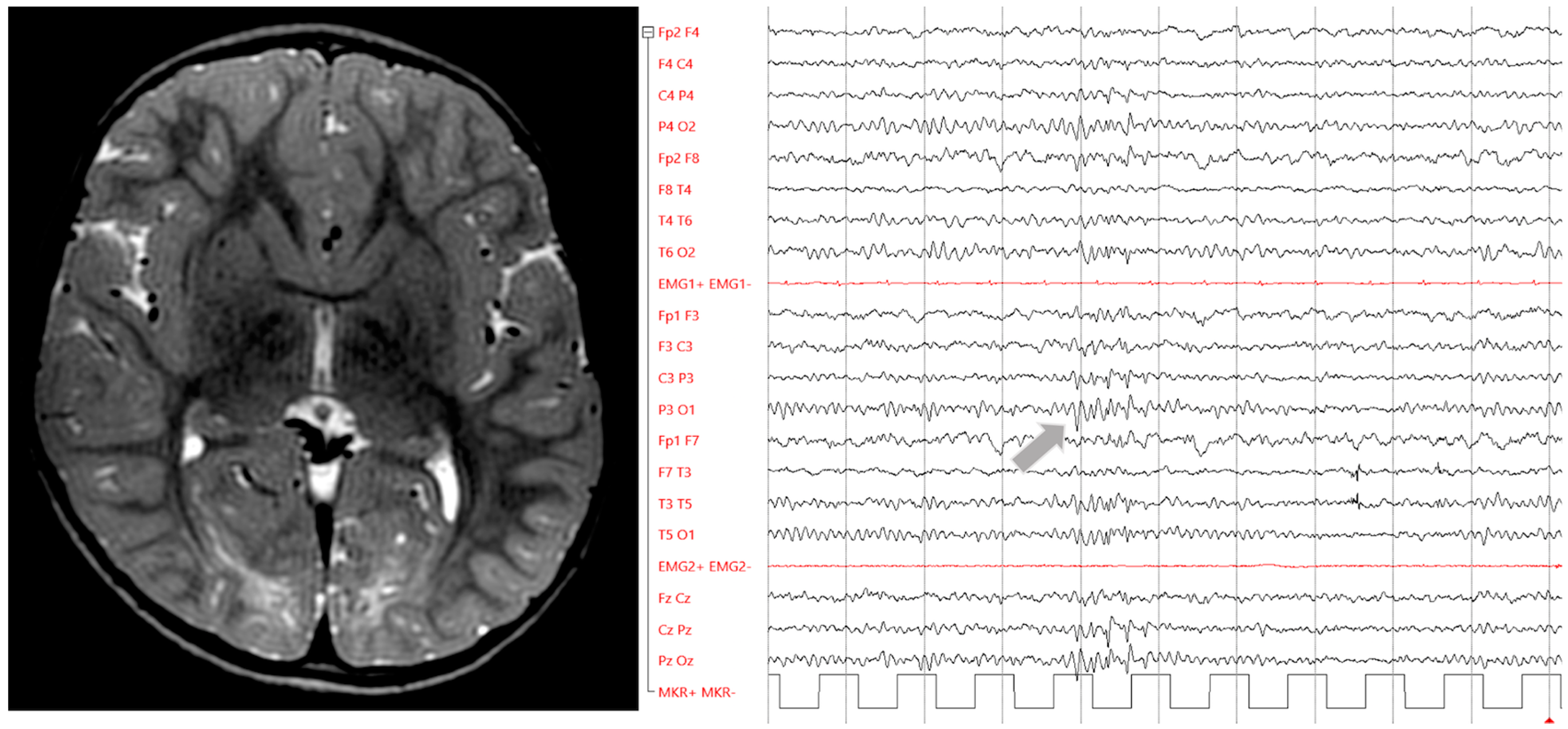 Jcm 12 02580 g003 Jcm 12 02580 g003