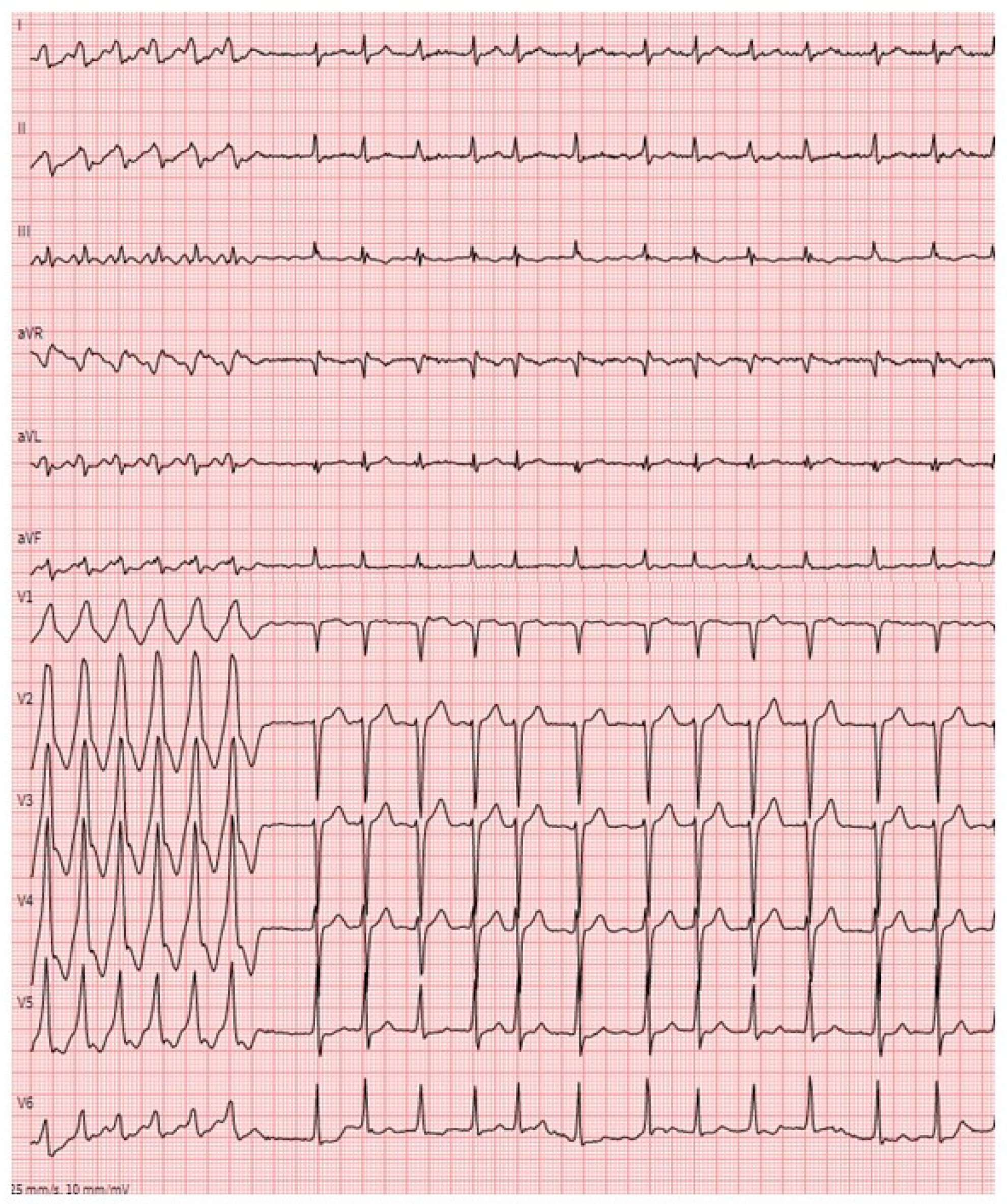 Jcm 12 02581 g005 Jcm 12 02581 g005