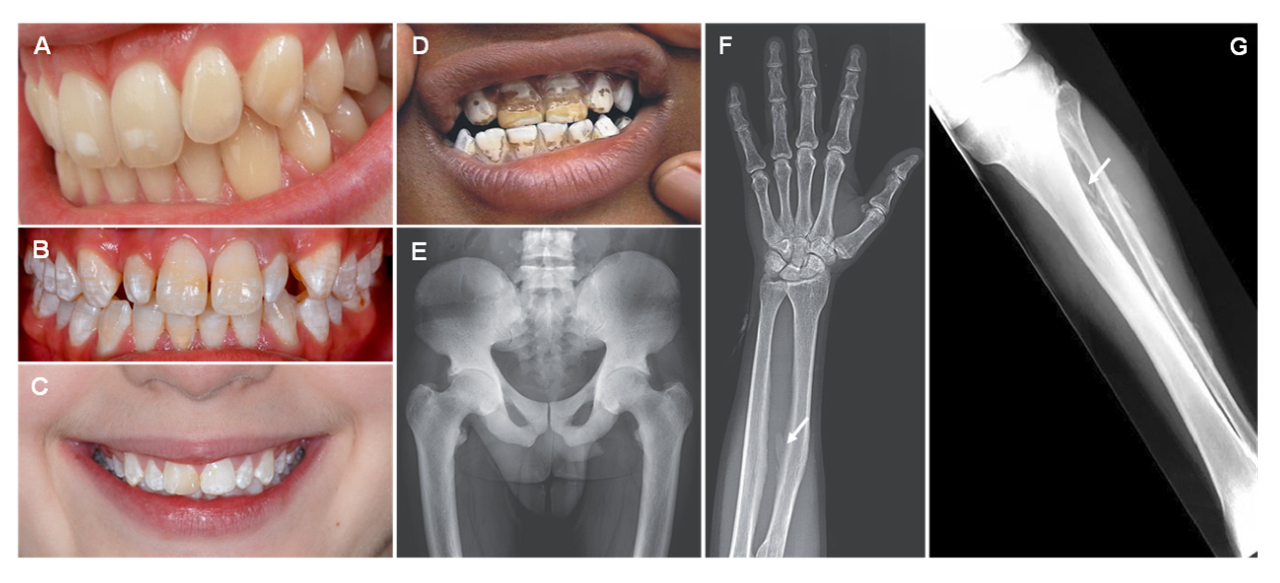 Jcm 12 02591 g004 Jcm 12 02591 g004