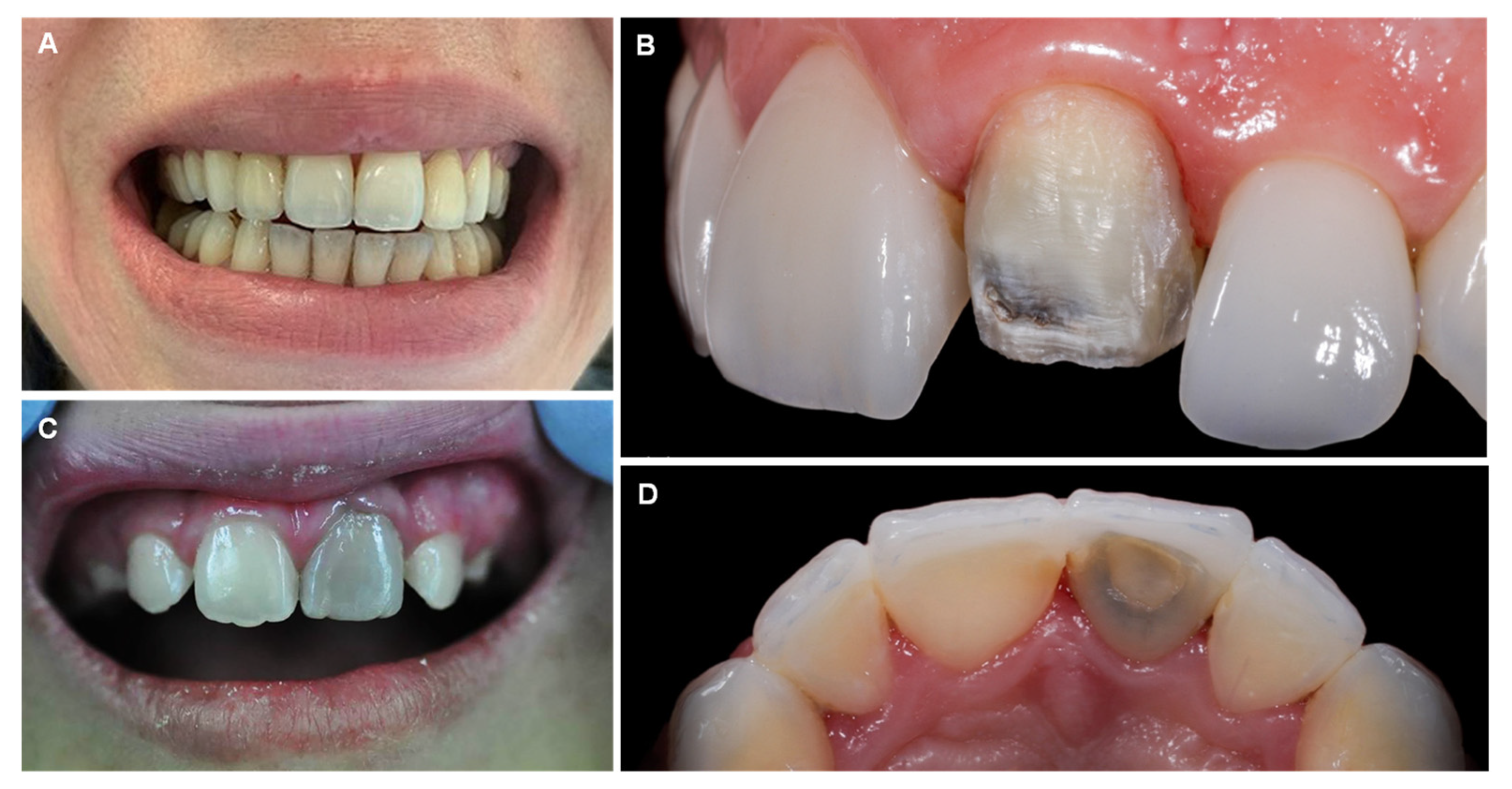 Jcm 12 02591 g010 Jcm 12 02591 g010