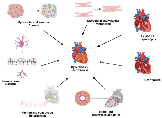 JCM Free Full Text Hypertensive Heart Disease A Narrative Review jcm-free-full-text-hypertensive-heart-disease-a-narrative-review